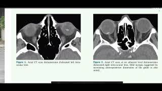BRAIN AND SPINE RADIOLOGY TEACHING FILE