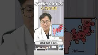 하부위장관 출혈의 원인 ① 게실 출혈ㅣ부산백병원 소화기내과 이홍섭 교수