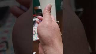 Bump on thumb