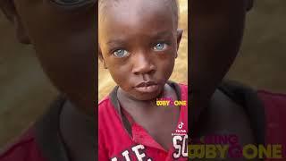 A pure blooded dark skinned African with blue eyes️