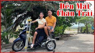 Hai anh em cùng chung Số Phận đều mất một cái Chân Trái