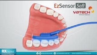 EzSensor SOFT de Vatech, Radiovisiografo Periapical