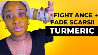 DIY TURMERIC FACE MASK!!! DAY 2