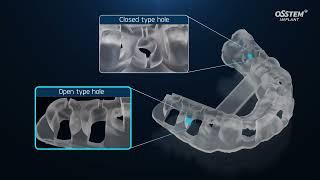 Osstem ONEGUIDE VIDEO Kompodent