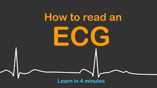 How to read an ECG