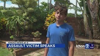 Assault victim hopes "something can be done about this"