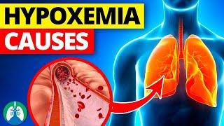 THIS is Causing Your Low Oxygen Levels | Hypoxemia Causes