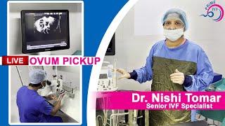 LIVE IVF Procedure | Ovum Pickup in IVF | Oocyte Retrieval Procedure Video | Best IVF in Delhi NCR