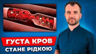 Розрідження густої крові БЕЗ ТАБЛЕТОК! З'їжте ці продукти