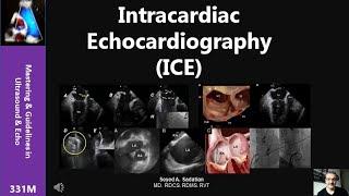 Intracardiac Echocardiography (ICE)