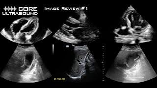 Core Ultrasound Image Review #1