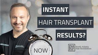 Instant Hair Transplant Results?