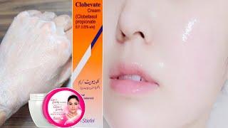 Add Clobevate Cream In Fair & Lovely Cream & Get Full Fairness | Face Whitening with clobevate cream