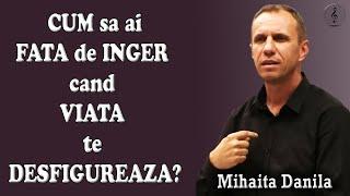 Mihaita Danila - CUM sa ai FATA de INGER cand VIATA te DESFIGUREAZA? | PREDICI