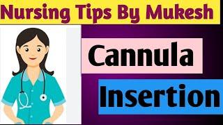 I V Cannula Procedure | Nursing tips by Mukesh | Nursing | Nursing students