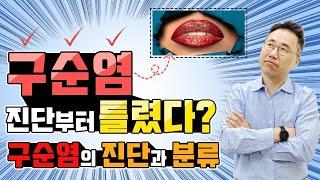 구순염은 안 낫는 이유는 진단과 분류가 틀려서 입니다구순염의 정확한 진단과 분류