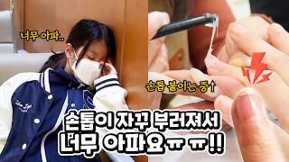 유니 손톱이 너무 아파요 자꾸 갈라지고 깨지는데 왜 그러는 걸까요? 손톱이 깨지는 이유 깨졌을 때 대처 병원에서 피 뽑는데 바늘을 두번 찔렸어요 ㅠ 채혈 검사 브이로그 가족 일상