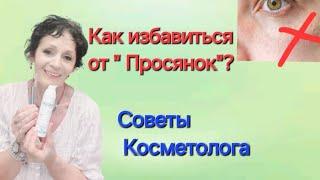 КАК ИЗБАВИТЬСЯ ОТ " ПРОСЯНОК"? Советы Косметолога.