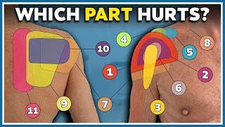 My shoulder hurts here! 12 most common pain locations and what they mean