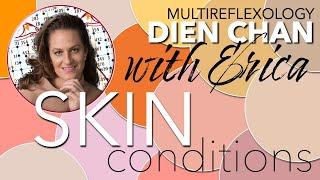 Skin conditions in Dien Chan  & Chanbeauté