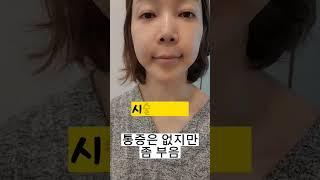 붓기 빠지는 과정 - 자연스러운 볼륨 #쥬베룩