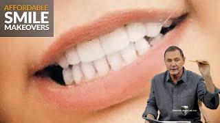 The Most Affordable Smile Makeovers with Dental Veneers from Brighter Image Lab