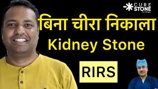 Laser kidney Stone Treatment | बिना चीरा निकले  Kidney Stone | RIRS -Kidney Stone Removal #treatment