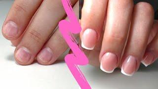 Incredible Nail Transformation | French Manicure | How to do a French tip Manicure