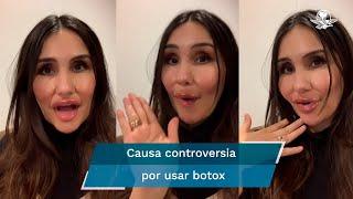 Dulce María alborota a fans con su rostro "lleno de bótox"