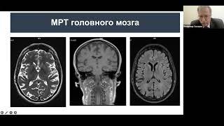 Ятрогенная Энцефалопатия Вернике Корсакова