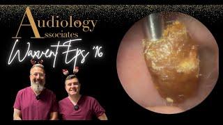 SOLID EAR WAX PLUG REMOVAL - WAXVENT 16