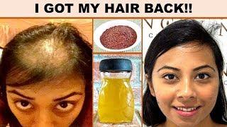 FAST HAIR GROWTH  SERUM - ALL NATURAL - APPLY TO HAIR ROOTS TO GET TREMENDOUS HAIR GROWTH FAST