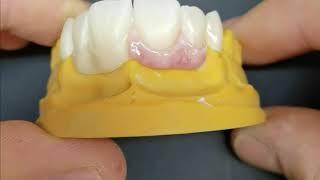 Let us see how  3D Smart Dent ( Romania ) - Aidite Biomic Gum