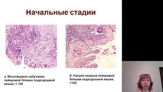 Патанатомия 16. Кишечные инфекции