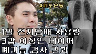 매일 3갑 분량 피는 전자담배 유저의 폐기능검사결과 및 폐 엑스레이 사진