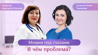 Мешки под глазами  В чём причина? Остеопат Юлия Лемешева. Невролог Маргарита Россова.