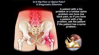 Spine or Hip Pain, Hip joint pain or nerve pain - Everything You Need To Know - Dr. Nabil Ebraheim