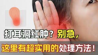 打耳洞红肿？别急，这里有超实用的处理方法！#科普 #health