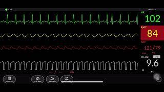 Simulated Patient Monitor