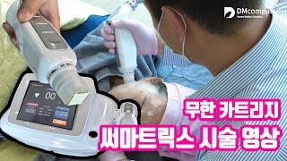 고주파관리기기 써마트릭스 시술영상 ㅣ high frequency instrument