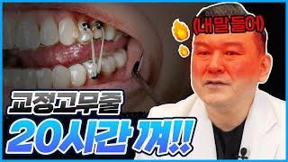 교정의 메인 치료! 20시간 착용해야 하는 교정 고무줄!