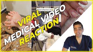 Doctor Reacts to Crazy Viral Medical Videos