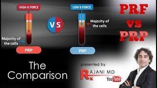 PRF vs PRP We Compare