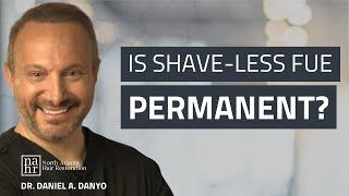 Is Shave-Less FUE Permanent?