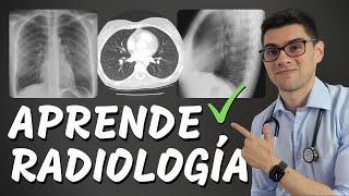 ¿Cómo Aprender Radiología Sin Morir en el Intento? | NUEVO Diplomado Radiología