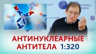 Антинуклеарные антитела 1:320. ЧТО ДЕЛАТЬ? Отвечает доктор Гузов.