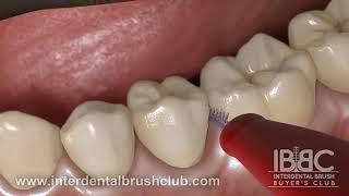How to use Interdental Toothbrush?
