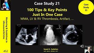 Case Study 21: 100 Tips & Key Points Just In One Case