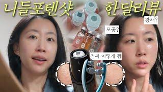 리뷰 하지 않을 수 없었던 요즘 나의 최애 디바이스 ️ 모공 고민이신 분들 꼭 보세요 ‼️ (B&A 있음)