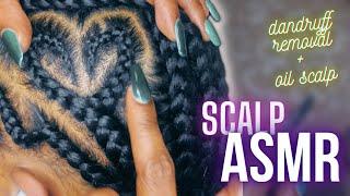 ASMR | real person scalp, scratching, dandruff removal + oiling | BLACK GIRL BRAIDS EDITION*